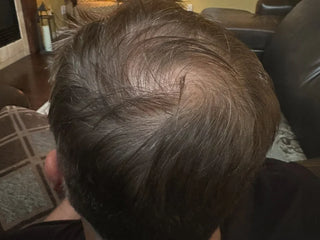 Xtresse Hair Growth Gummy
