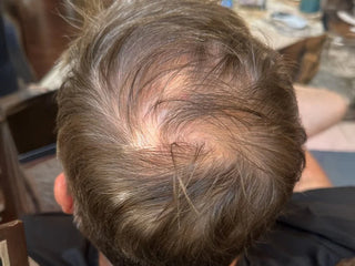 Xtresse Hair Growth Gummy