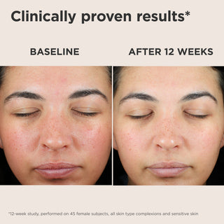 UV Skin Recovery Broad Spectrum SPF 50 Face Sunscreen